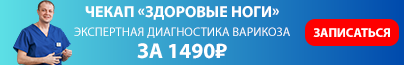 Чекап 'Здоровые ноги' - комплексное обследование здоровья ваших ног за 1490₽